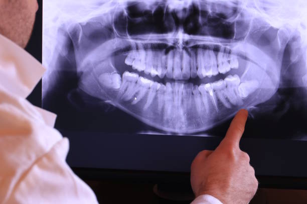 Best Emergency Denture Repair in Swede Heaven, WA