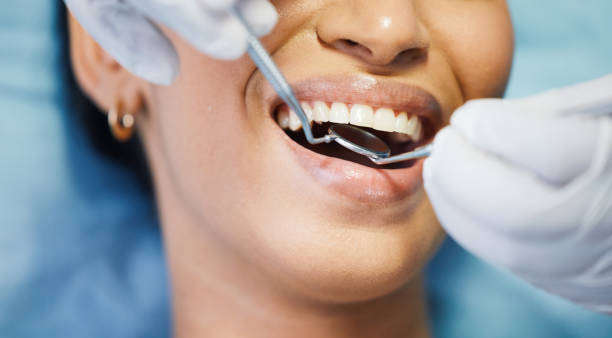 Best Emergency Wisdom Tooth Extraction in Swede Heaven, WA